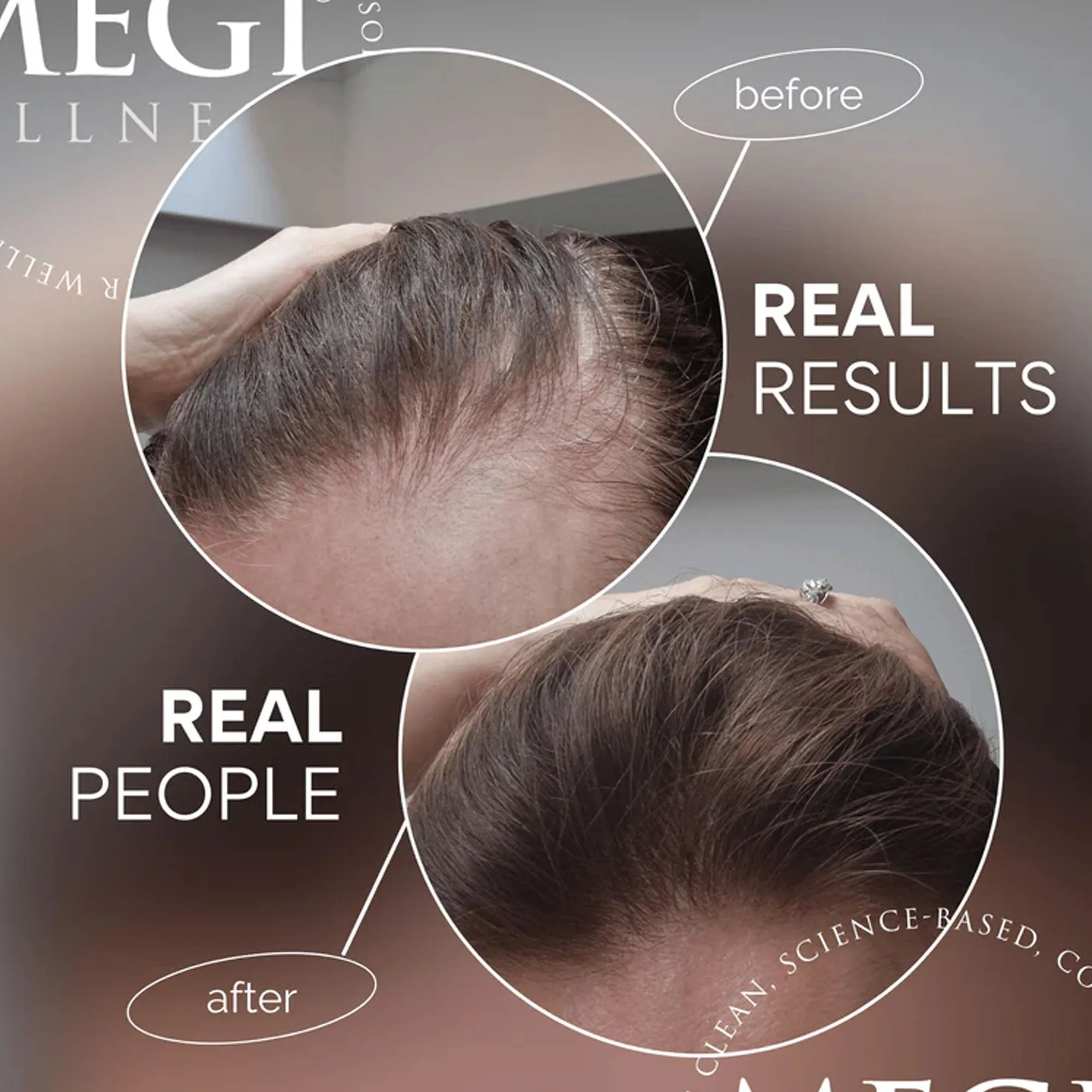 Megi Wellness Growth & Repair Set